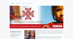 Desktop Screenshot of nepalcleftandburncenter.org