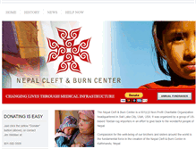 Tablet Screenshot of nepalcleftandburncenter.org